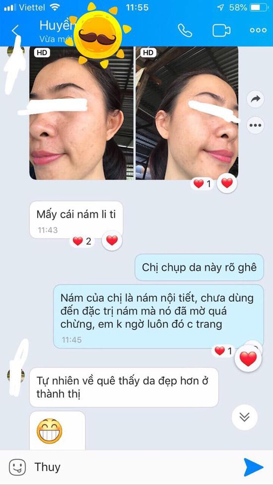 review-kem-tri-nam-nacos-han-quoc-7