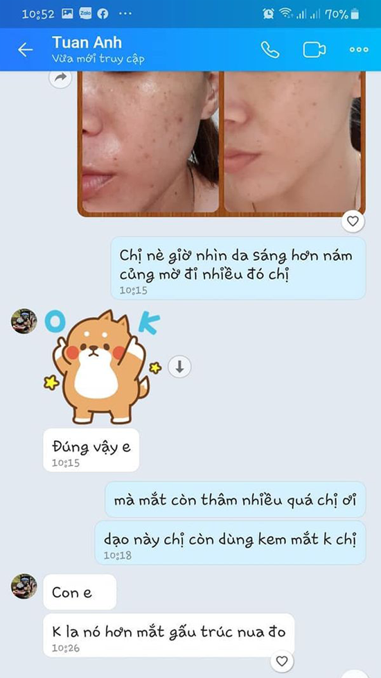 review-kem-tri-nam-nacos-han-quoc-9