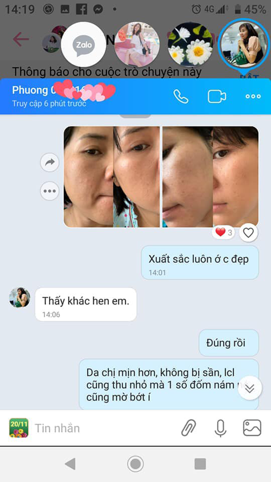 review-kem-tri-nam-nacos-han-quoc-9