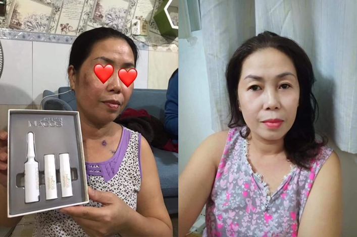 review-kem-tri-nam-nacos-han-quoc