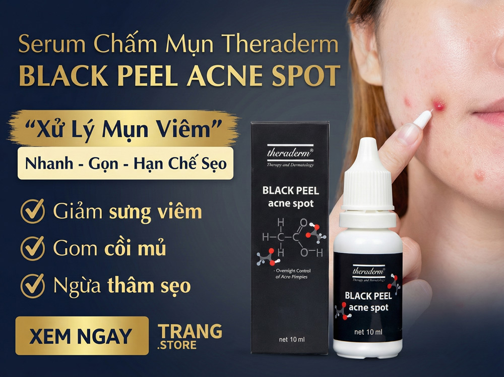 theraderm-black-peel-acne-spot-chinh-hang-dieu-tri-mun-han-quoc-trangstore